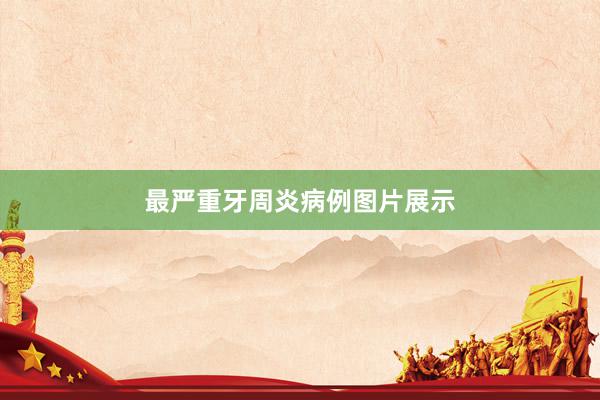 最严重牙周炎病例图片展示